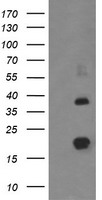 MCTS1 Antibody - Negative control E. coli lysate (Left lane) or E. coli lysate containing recombinant protein fragment for human MCTS1 (NP_054779) gene (amino acids 1-181) (Right lane). Equivalent amounts (5 ug per lane) were separated by SDS-PAGE and then immunoblotted with anti-MCTS1. .