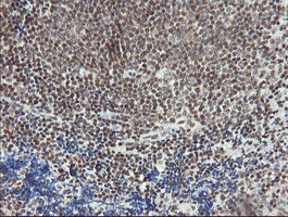 MCTS1 Antibody - IHC of paraffin-embedded Human tonsil using anti-MCTS1 mouse monoclonal antibody.