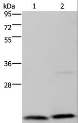 MCTS1 Antibody - Western blot analysis of Jurkat and PC3 cell, using MCTS1 Polyclonal Antibody at dilution of 1:200.