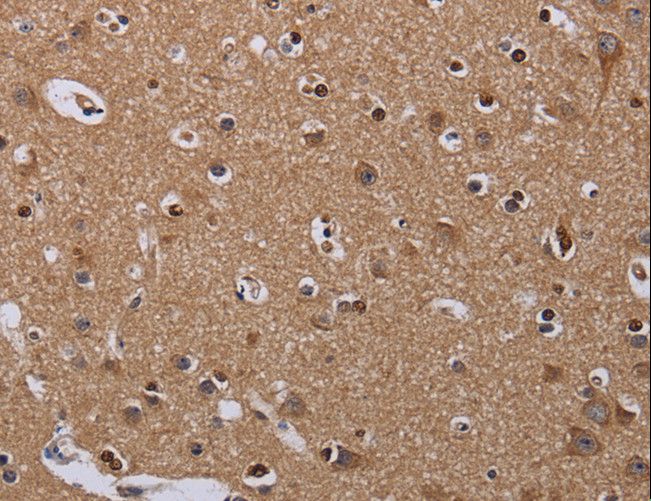 MCTS1 Antibody - Immunohistochemistry of paraffin-embedded Human brain using MCTS1 Polyclonal Antibody at dilution of 1:60.