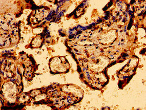 MCU / CCDC109A Antibody - Immunohistochemistry image of paraffin-embedded human placenta tissue at a dilution of 1:100
