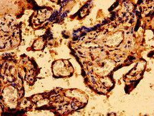 MCU / CCDC109A Antibody - Immunohistochemistry image of paraffin-embedded human placenta tissue at a dilution of 1:100