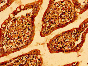 MCU / CCDC109A Antibody - Immunohistochemistry image of paraffin-embedded human small intestine tissue at a dilution of 1:100