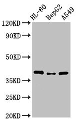 MCU / CCDC109A Antibody - Positive Western Blot detected in HL-60 whole cell lysate, HepG2 whole cell lysate, A549 whole cell lysate. All lanes: MCU antibody at 3.4 µg/ml Secondary Goat polyclonal to rabbit IgG at 1/50000 dilution. Predicted band size: 40, 37, 36 KDa. Observed band size: 40 KDa