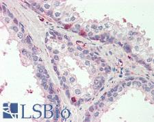 MCUR1 / CCDC90A Antibody - Anti-MCUR1 / CCDC90A antibody IHC staining of human prostate. Immunohistochemistry of formalin-fixed, paraffin-embedded tissue after heat-induced antigen retrieval. Antibody concentration 5 ug/ml.  This image was taken for the unconjugated form of this product. Other forms have not been tested.