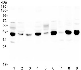 MCUR1 / CCDC90A Antibody - Western blot testing of human 1) HeLa, 2) MDA-MB-231, 3) HL-60, 4) MDA-MB-453, 5) A431, 6) Caco-2, 7) rat spleen, 8) mouse lung and 9) mouse ANA-1 lysate with MCUR1 antibody at 0.5ug/ml. Predicted molecular weight ~40 kDa.