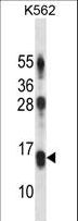 MD-1 / LY86 Antibody - LY86 Antibody western blot of K562 cell line lysates (35 ug/lane). The LY86 antibody detected the LY86 protein (arrow).