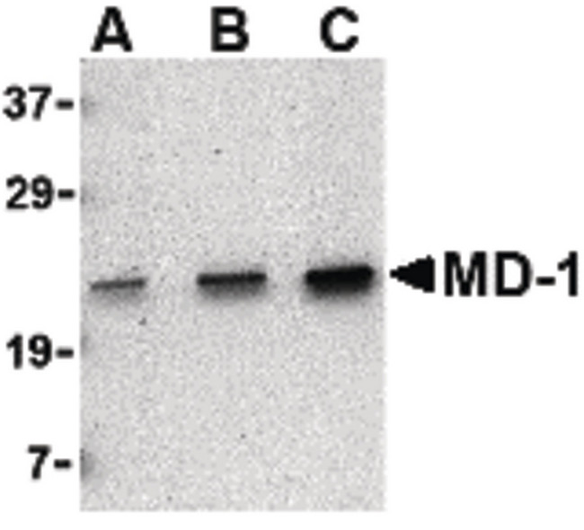 MD-1 / LY86 Antibody - Western blot of MD-1 in Daudi cell lysate with MD-1 antibody at (A) 0.5, (B) 1 and (C) 2 ug/ml.