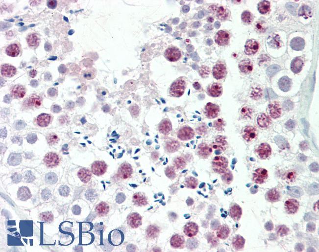 MDC1 Antibody - Human, Testis: Formalin-Fixed Paraffin-Embedded (FFPE).  This image was taken for the unconjugated form of this product. Other forms have not been tested.