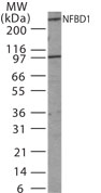 MDC1 Antibody - Western blot of NFBD1 in 30 ugs of Jurkat cell lysate using antibody at 1:1000 dilution.