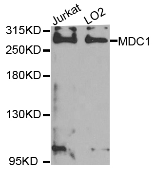 MDC1 Antibody - Western blot analysis of extracts of various cell lines.