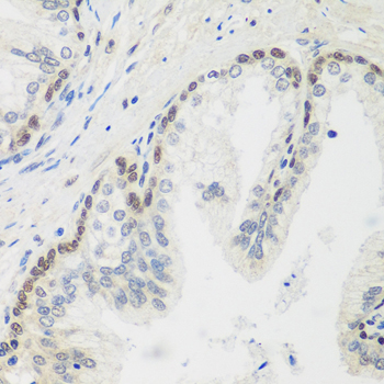 MDC1 Antibody - Immunohistochemistry of paraffin-embedded human prostate.