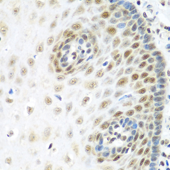 MDC1 Antibody - Immunohistochemistry of paraffin-embedded human esophagus.