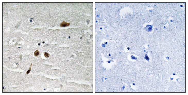 MDC1 Antibody - Immunohistochemistry analysis of paraffin-embedded human brain, using MDC1 (Phospho-Ser513) Antibody. The picture on the right is blocked with the phospho peptide.