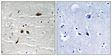 MDC1 Antibody - Immunohistochemistry analysis of paraffin-embedded human brain, using MDC1 (Phospho-Ser513) Antibody. The picture on the right is blocked with the phospho peptide.