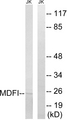 MDFI / I-MF Antibody - Western blot analysis of lysates from Jurkat cells, using MDFI Antibody. The lane on the right is blocked with the synthesized peptide.