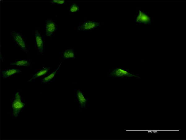 MDFI / I-MF Antibody - Immunofluorescence of monoclonal antibody to MDFI on HeLa cell . [antibody concentration 10 ug/ml]