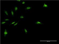 MDFI / I-MF Antibody - Immunofluorescence of monoclonal antibody to MDFI on HeLa cell . [antibody concentration 10 ug/ml]