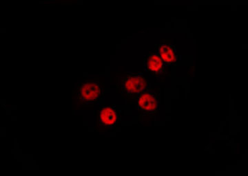 MDFI / I-MF Antibody - Staining HepG2 cells by IF/ICC. The samples were fixed with PFA and permeabilized in 0.1% Triton X-100, then blocked in 10% serum for 45 min at 25°C. The primary antibody was diluted at 1:200 and incubated with the sample for 1 hour at 37°C. An Alexa Fluor 594 conjugated goat anti-rabbit IgG (H+L) Ab, diluted at 1/600, was used as the secondary antibody.