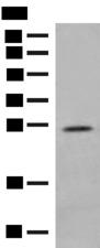 MDFI / I-MF Antibody - Western blot analysis of Human placenta tissue lysate  using MDFI Polyclonal Antibody at dilution of 1:400
