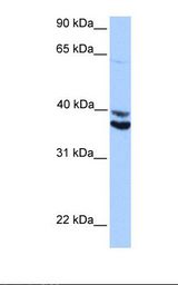 MDFIC / HIC Antibody - HepG2 cell lysate. Antibody concentration: 1.0 ug/ml. Gel concentration: 12%.  This image was taken for the unconjugated form of this product. Other forms have not been tested.