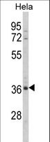 MDFIC / HIC Antibody - Western blot of MDFIC Antibody in HeLa cell line lysates (35 ug/lane). MDFIC (arrow) was detected using the purified antibody.