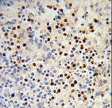 MDFIC / HIC Antibody - Formalin-fixed and paraffin-embedded human spleen reacted with MDFIC Antibody , which was peroxidase-conjugated to the secondary antibody, followed by DAB staining. This data demonstrates the use of this antibody for immunohistochemistry; clinical relevance has not been evaluated.