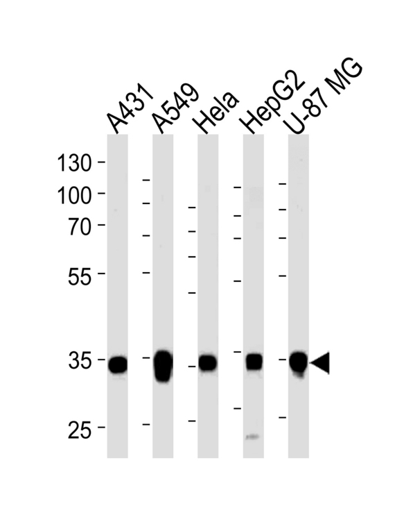MDH / MDH2 Antibody - Western blot of lysates from A431, A549, HeLa, HepG2, U-87 MG cell line (from left to right), using MDH2 Antibody. Antibody was diluted at 1:1000 at each lane. A goat anti-rabbit IgG H&L (HRP) at 1:5000 dilution was used as the secondary antibody. Lysates at 35ug per lane.