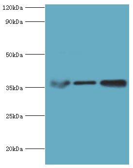 MDH / MDH2 Antibody - Western blot. All lanes: Malate dehydrogenase, mitochondrial antibody at 3 ug/ml. Lane 1: mouse lung tissue. Lane 2: 293T whole cell lysate. Lane 3: K562 whole cell lysate. secondary Goat polyclonal to rabbit at 1:10000 dilution. Predicted band size: 36 kDa. Observed band size: 36 kDa.