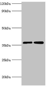 MDH / MDH2 Antibody - Western blot All lanes: MDH2 antibody at 3µg/ml Lane 1: 293T whole cell lysate Lane 2: K562 whole cell lysate Secondary Goat polyclonal to rabbit IgG at 1/10000 dilution Predicted band size: 36, 31 kDa Observed band size: 36 kDa