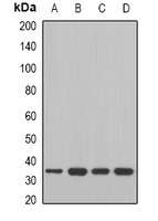 MDH / MDH2 Antibody - Western blot analysis of MDH2 expression in Jurkat (A); A549 (B); mouse liver (C); mouse heart (D) whole cell lysates.
