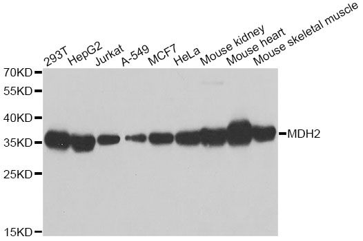 MDH / MDH2 Antibody - Western blot analysis of extracts of various cell lines, using MDH2 antibody at 1:1000 dilution. The secondary antibody used was an HRP Goat Anti-Rabbit IgG (H+L) at 1:10000 dilution. Lysates were loaded 25ug per lane and 3% nonfat dry milk in TBST was used for blocking. An ECL Kit was used for detection and the exposure time was 1s.