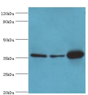 MDH1 Antibody - Western blot. All lanes: Malate dehydrogenase, cytoplasmic antibody at 4 ug/ml. Lane 1: HepG2 whole cell lysate. Lane 2: HeLa whole cell lysate. Lane 3: mouse kidney tissue. secondary Goat polyclonal to rabbit at 1:10000 dilution. Predicted band size: 36 kDa. Observed band size: 36 kDa.