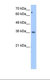 MDH1 Antibody - Jurkat cell lysate. Antibody concentration: 2.5 ug/ml. Gel concentration: 12%.  This image was taken for the unconjugated form of this product. Other forms have not been tested.