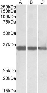 MDH1 Antibody - MDH1 antibody (0.01 ug/ml) staining of Human (A), Mouse (B) and Rat (C) Heart lysate (35 ug protein in RIPA buffer). Primary incubation was 1 hour. Detected by chemiluminescence.