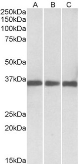MDH1 Antibody - MDH1 antibody (0.03 ug/ml) staining of Human (A), Mouse(B) and Rat (C) lysates (35 ug protein in RIPA buffer). Primary incubation was 1 hour. Detected by chemiluminescence.