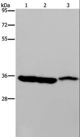 MDH1 Antibody - Western blot analysis of Mouse heart, liver and stomach tissue, using MDH1 Polyclonal Antibody at dilution of 1:500.