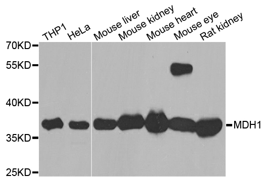 MDH1 Antibody - Western blot analysis of extracts of various cell lines.