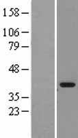 MDH1 Protein - Western validation with an anti-DDK antibody * L: Control HEK293 lysate R: Over-expression lysate