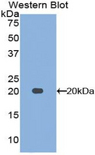 MDK / Midkine Antibody - Western blot of recombinant MDK / Midkine.  This image was taken for the unconjugated form of this product. Other forms have not been tested.
