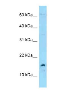 MDK / Midkine Antibody - MDK / Midkine antibody Western blot of 3 Cell lysate. Antibody concentration 1 ug/ml.  This image was taken for the unconjugated form of this product. Other forms have not been tested.