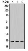MDK / Midkine Antibody - Western blot analysis of Midkine expression in HeLa (A); mouse kidney (B); rat liver (C) whole cell lysates.