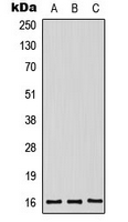 MDK / Midkine Antibody - Western blot analysis of Midkine expression in HeLa (A); HepG2 (B); mouse kidney (C) whole cell lysates.