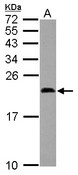 MDK / Midkine Antibody - Sample (30 ug of whole cell lysate) A: MCF-7 15% SDS PAGE MDK / Midkine antibody diluted at 1:1000