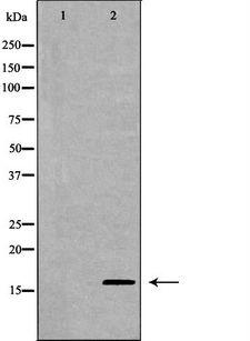 MDK / Midkine Antibody - Western blot analysis of extracts of SW480 using MDK antibody. The lane on the left is treated with the antigen-specific peptide.