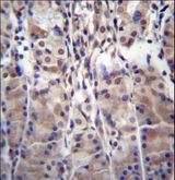 MDM1 Antibody - MDM1 Antibody immunohistochemistry of formalin-fixed and paraffin-embedded human stomach tissue followed by peroxidase-conjugated secondary antibody and DAB staining.