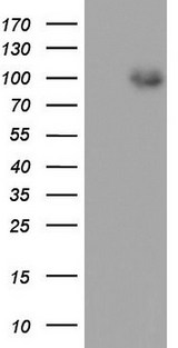 MDM2 Antibody - HEK293T cells were transfected with the pCMV6-ENTRY control. (Left lane) or pCMV6-ENTRY MDM2. (Right lane) cDNA for 48 hrs and lysed. Equivalent amounts of cell lysates. (5 ug per lane) were separated by SDS-PAGE and immunoblotted with anti-MDM2.