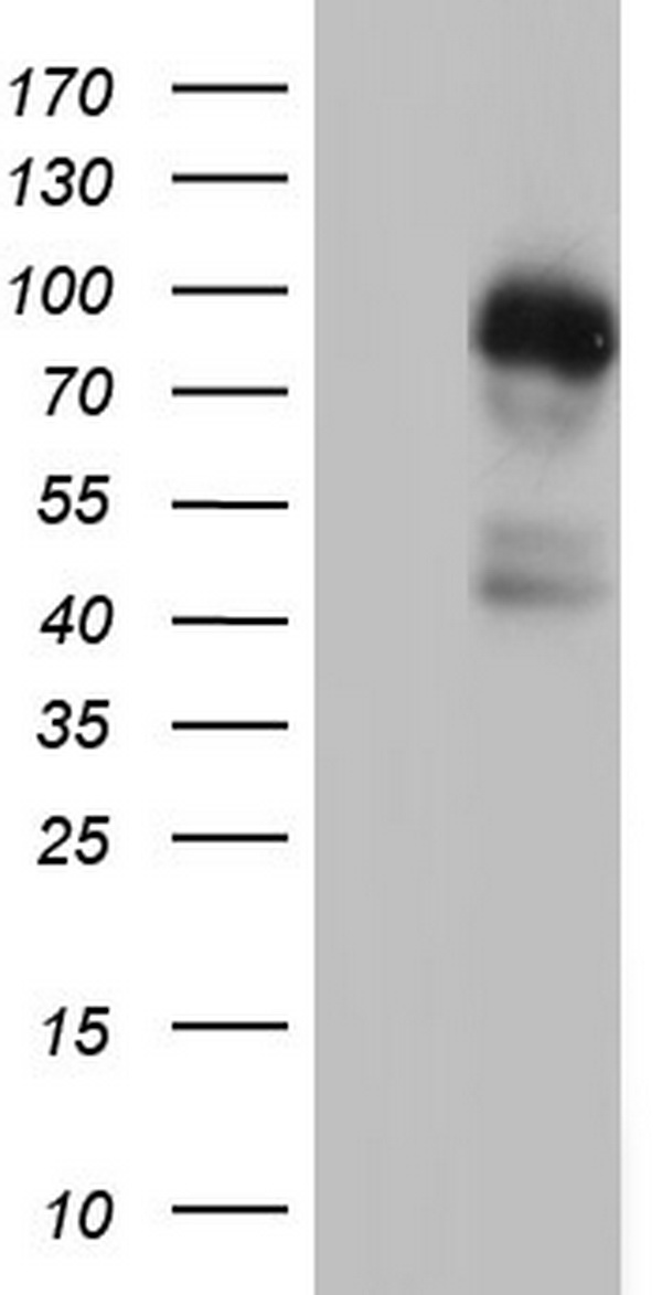 MDM2 Antibody - HEK293T cells were transfected with the pCMV6-ENTRY control. (Left lane) or pCMV6-ENTRY MDM2. (Right lane) cDNA for 48 hrs and lysed. Equivalent amounts of cell lysates. (5 ug per lane) were separated by SDS-PAGE and immunoblotted with anti-MDM2.