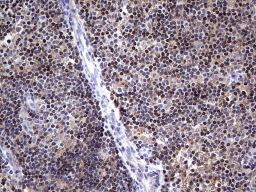 MDM2 Antibody - Immunohistochemical staining of paraffin-embedded Human tonsil within the normal limits using anti-MDM2 mouse monoclonal antibody. (Heat-induced epitope retrieval by 1 mM EDTA in 10mM Tris, pH8.5, 120C for 3min,
