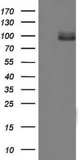 MDM2 Antibody - HEK293T cells were transfected with the pCMV6-ENTRY control (Left lane) or pCMV6-ENTRY MDM2 (Right lane) cDNA for 48 hrs and lysed. Equivalent amounts of cell lysates (5 ug per lane) were separated by SDS-PAGE and immunoblotted with anti-MDM2.